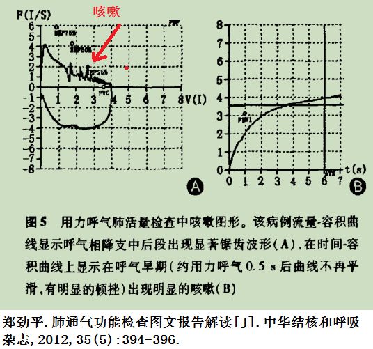 最新慢阻肺诊断标准，重塑诊断与治疗的方向探索